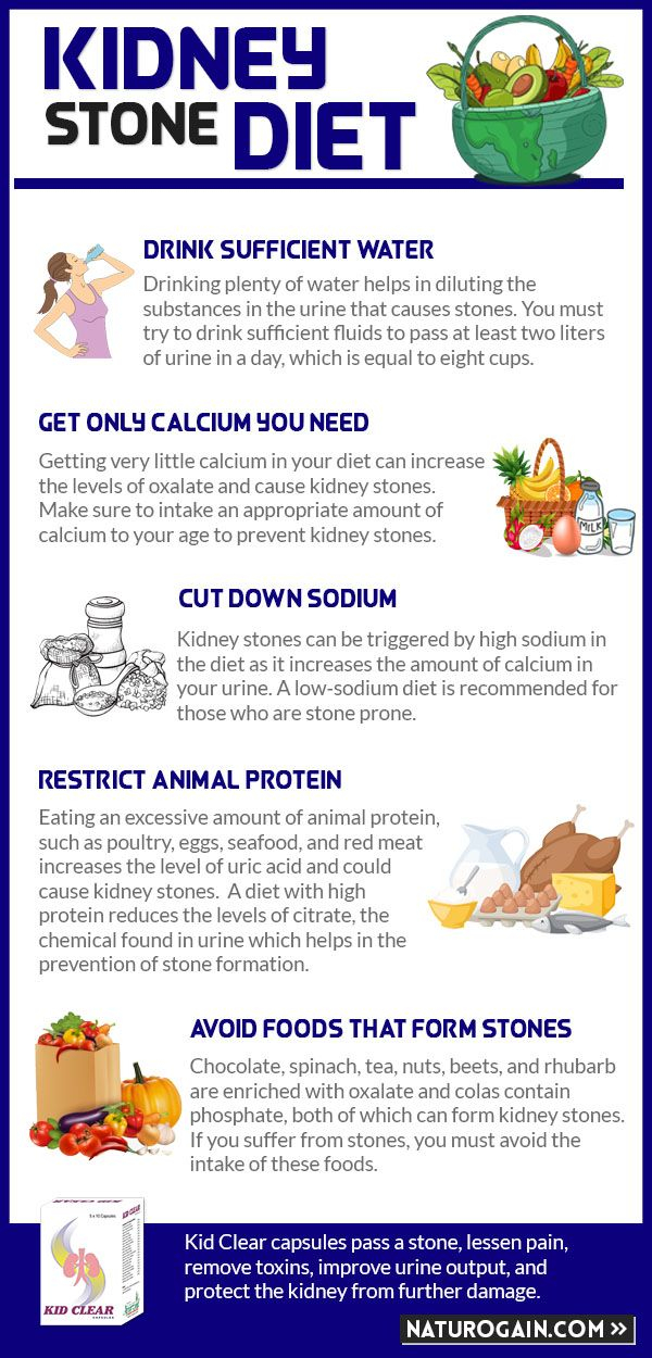 Kidney Stones Low Calcium Diet Kidneyoi
