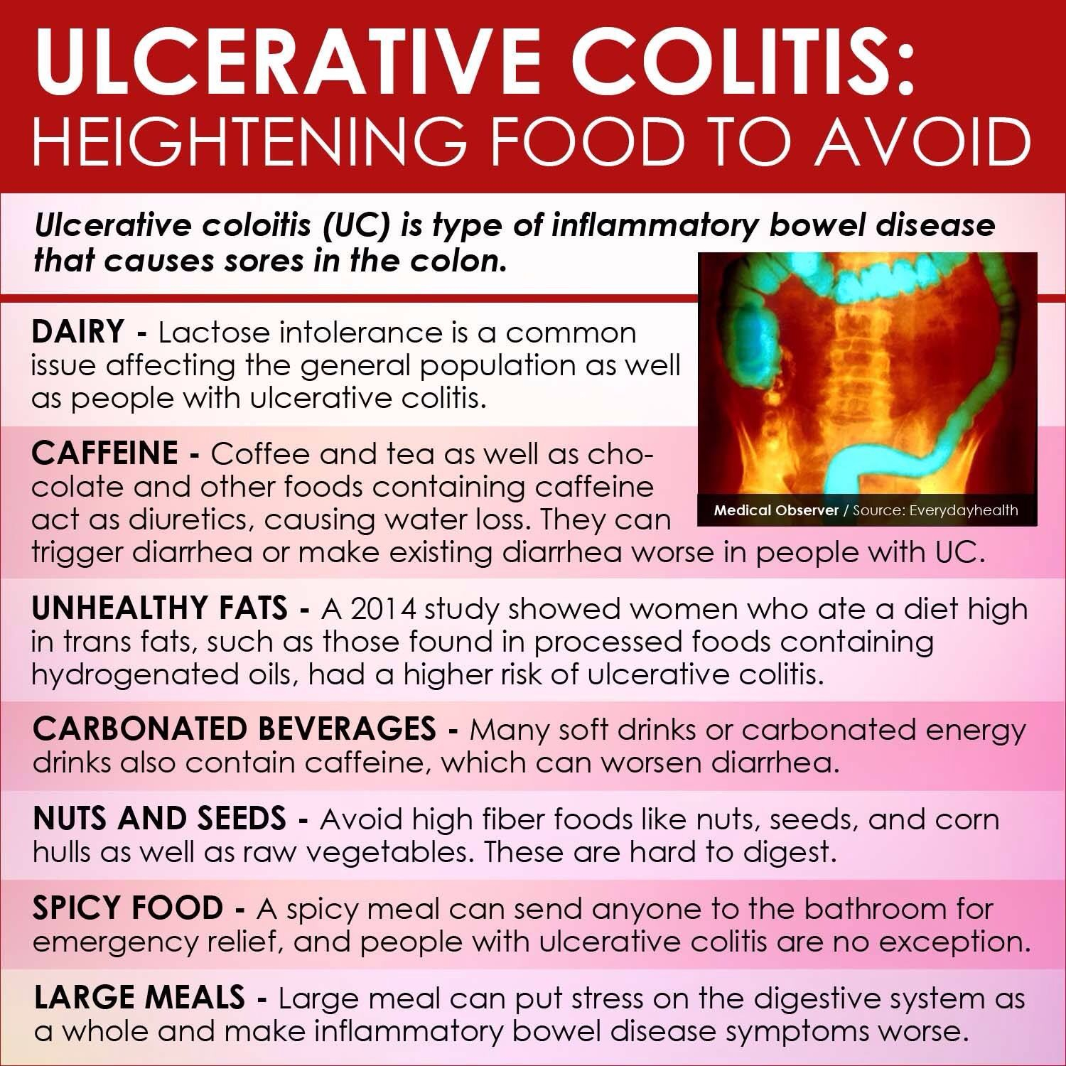 Pin On IBD