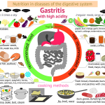 How To Improve Gastritis Symptoms Naturally Top 20