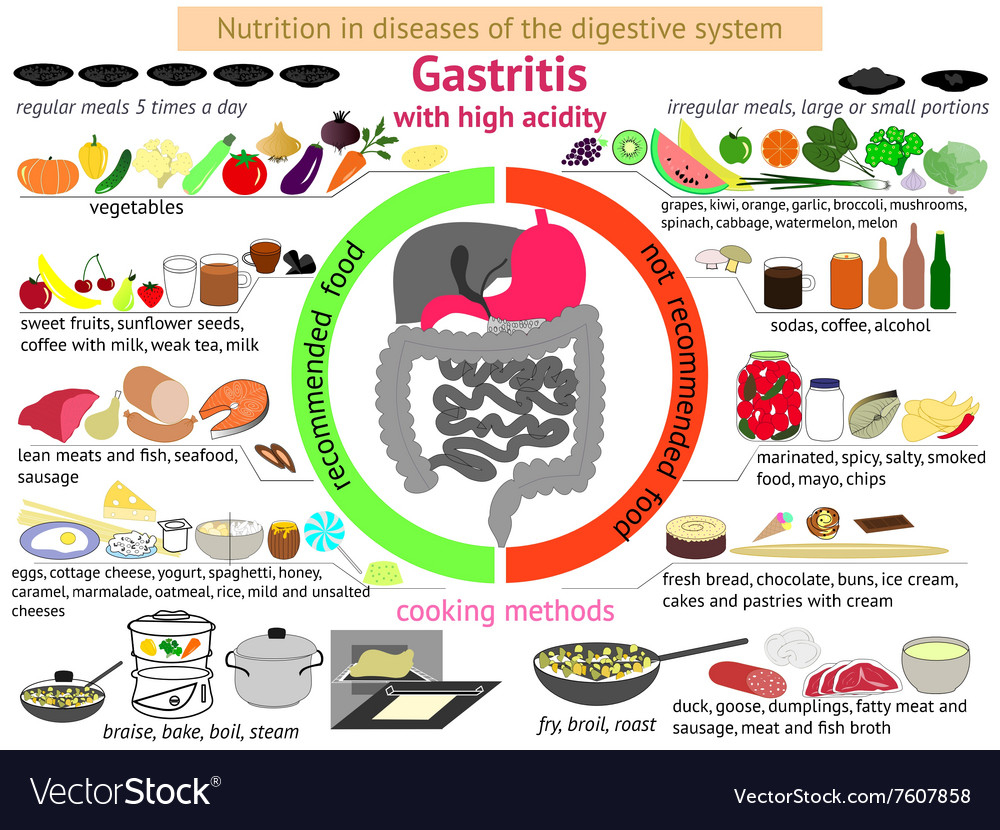 Infographics Proper Nutrition Gastritis Royalty Free Vector