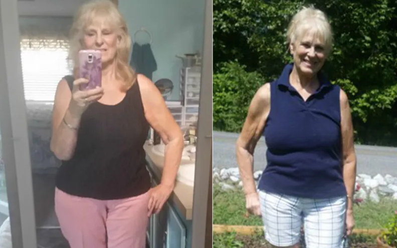 67 Keto Diet Weight Loss Before And After Pictures FEMALE