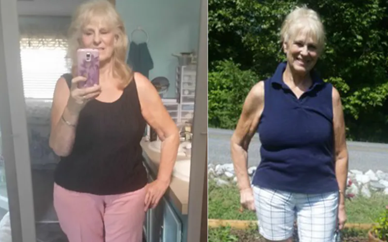 67 Keto Diet Weight Loss Before And After Pictures FEMALE 