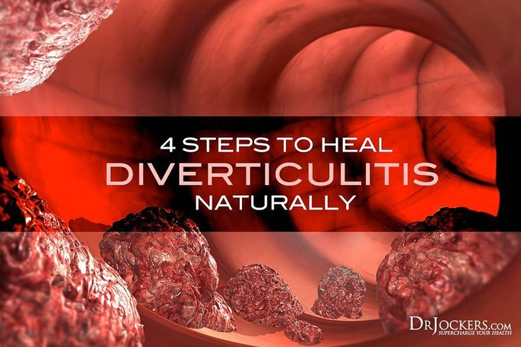 Diverticulitis Is An Inflammatory Condition Characterized