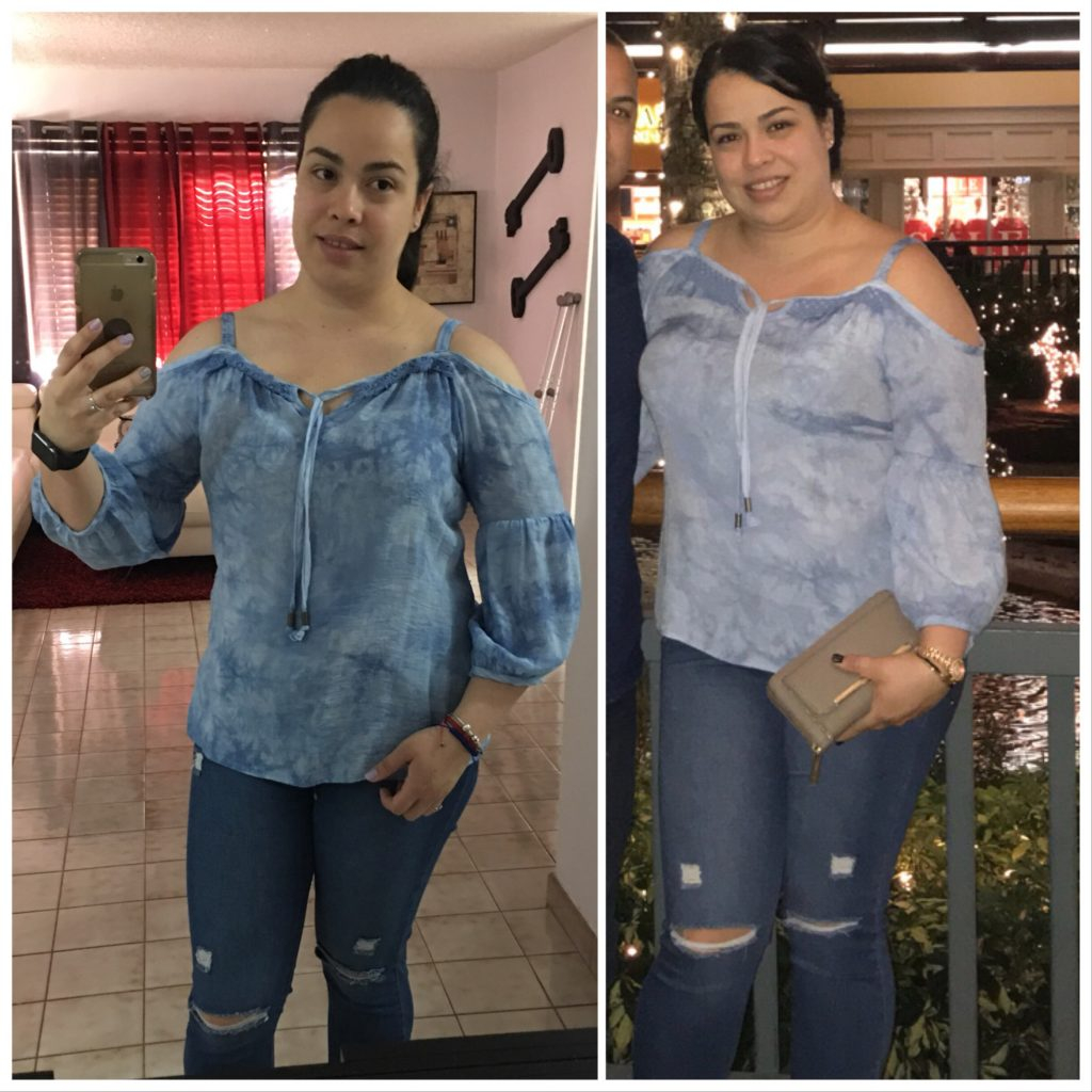 HCG Diet Pictures Results At HCG Diet Miami 1 HCG 