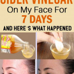 I Used Apple Cider Vinegar On My Face For 7 Days And Here