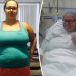 Obese Woman Loses 9st In One Year But Is Left With body