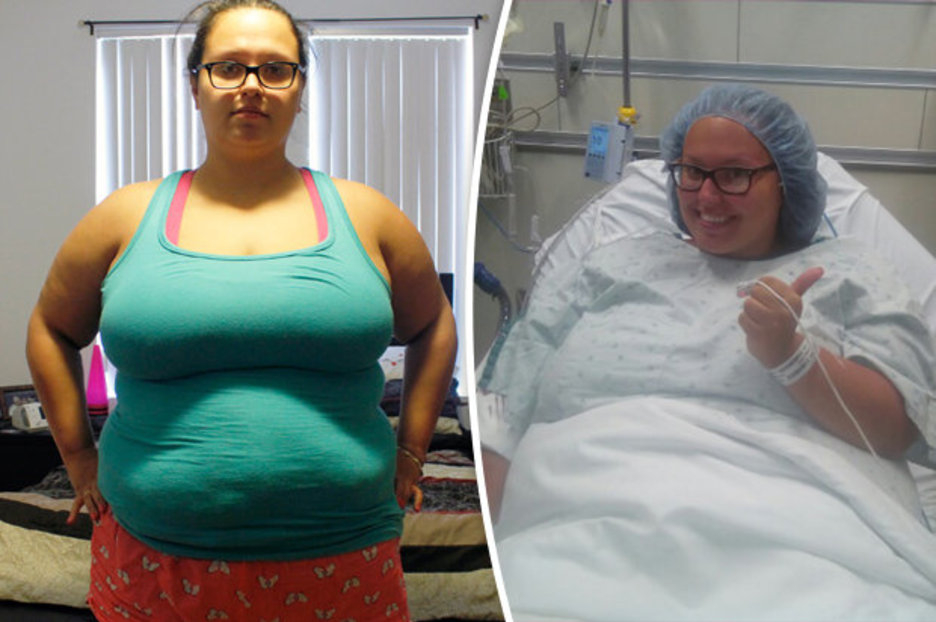 Obese Woman Loses 9st In One Year But Is Left With body 