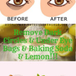 Remove Dark Circles Under Eye Bags Baking Soda Lemon