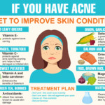 The Influence Of Diet On Acne Fact Or Myth