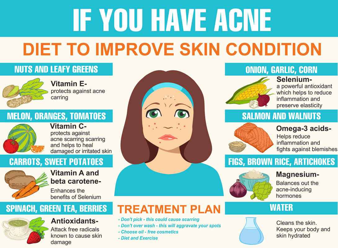 The Influence Of Diet On Acne Fact Or Myth 