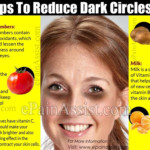 Tips To Reduce Dark Circles Reduce Dark Circles Dark