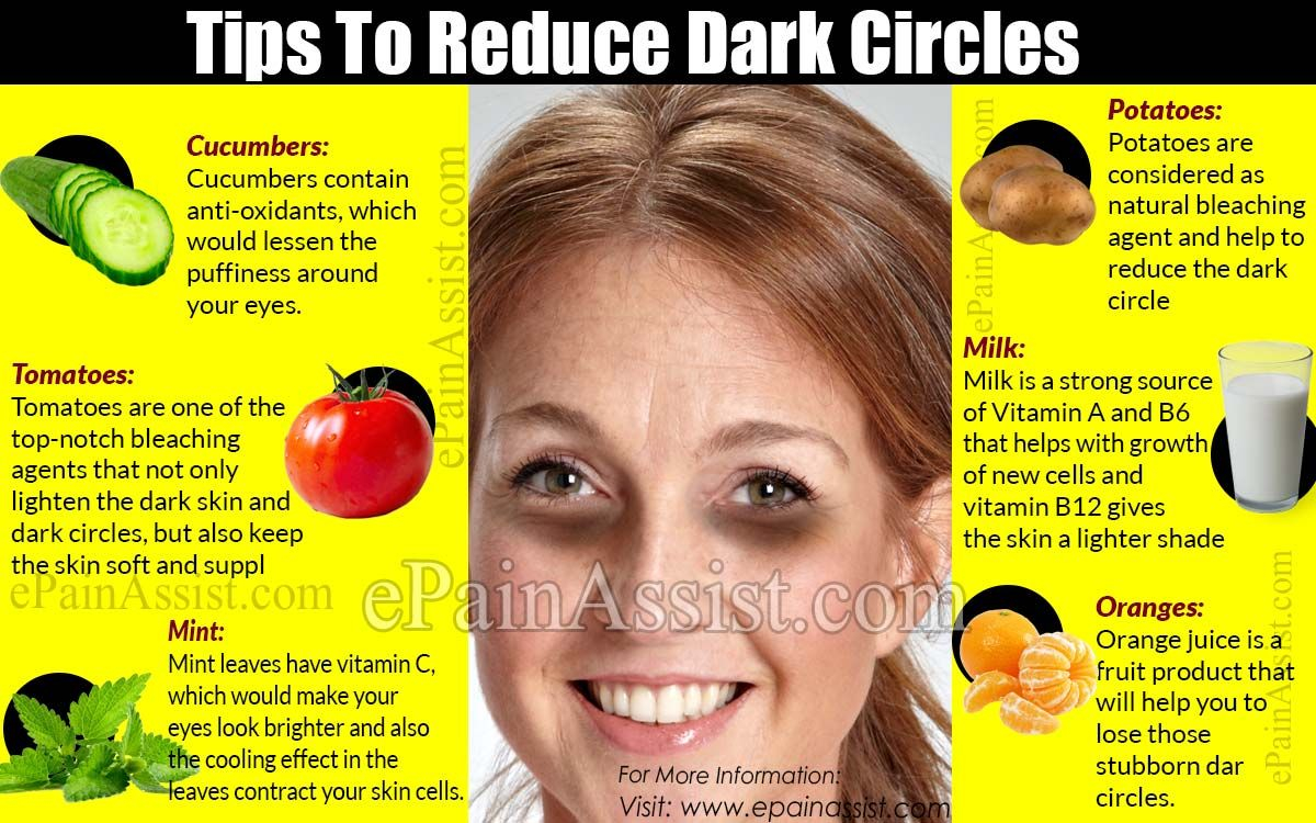 Tips To Reduce Dark Circles Reduce Dark Circles Dark 