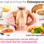 Best Diet And Foods For Osteoporosis Bone Healing Foods Osteoporosis