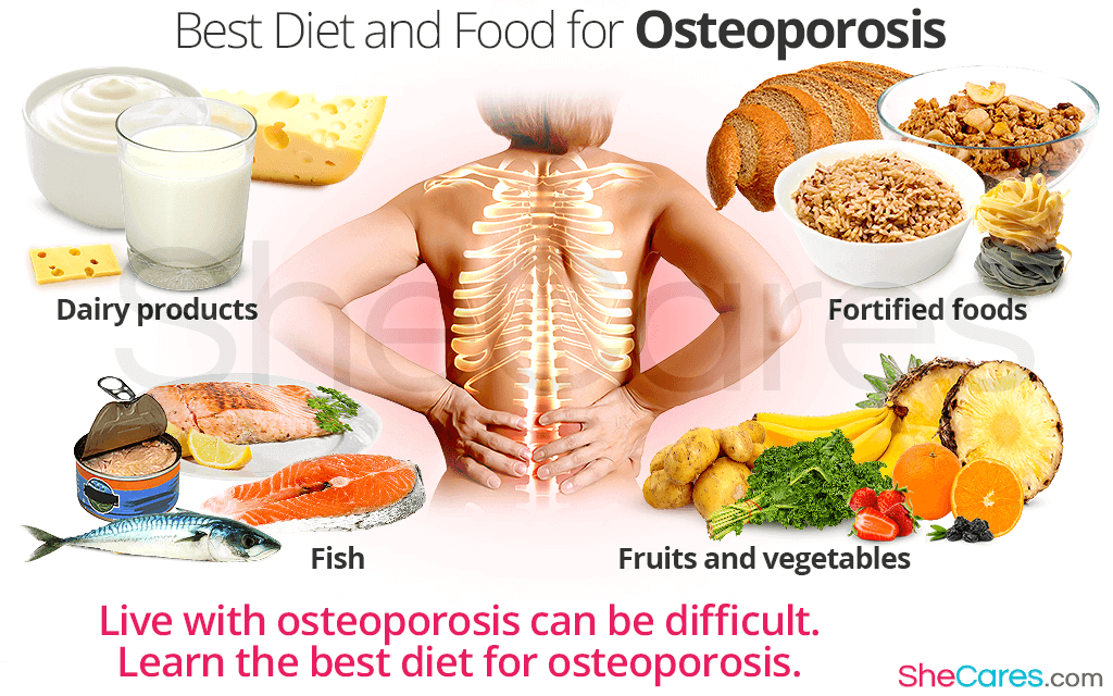 Best Diet And Foods For Osteoporosis Bone Healing Foods Osteoporosis