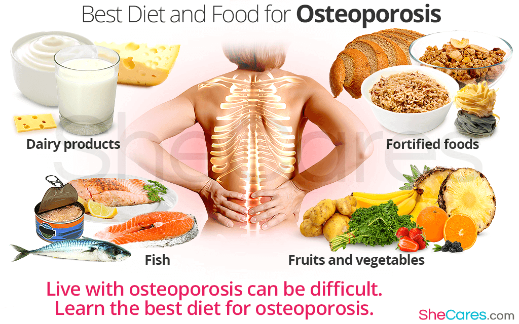 Best Diet And Foods For Osteoporosis Bone Healing Foods Osteoporosis 