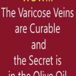 Pin On Varicose Veins