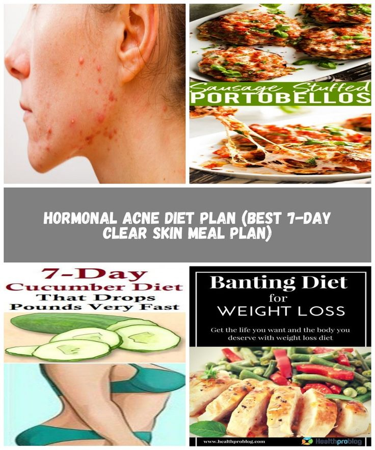 Hormonal Acne Diet Plan best 7 day Clear Skin Meal Plan 2SHAREMYJOY 