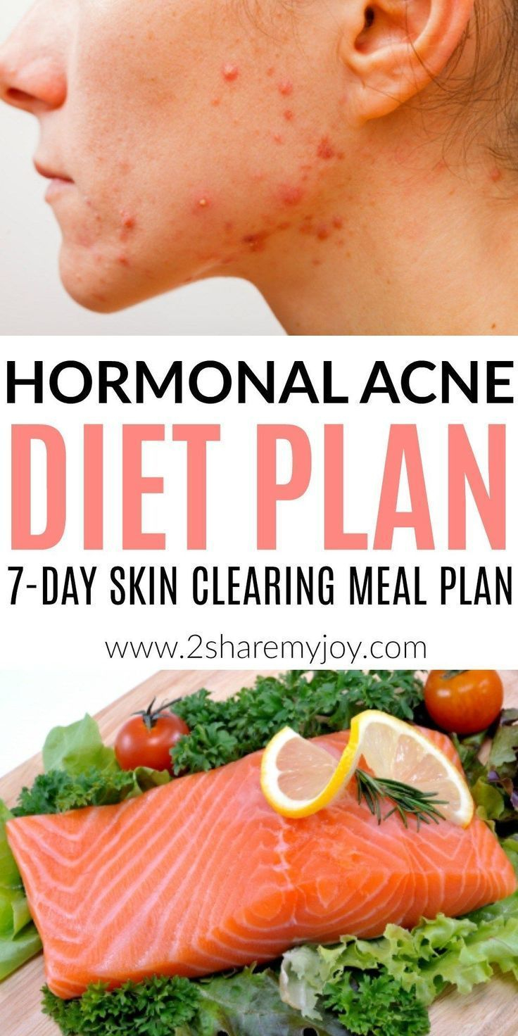 Hormonal Acne Diet Plan best 7 day Clear Skin Meal Plan Clear Skin 