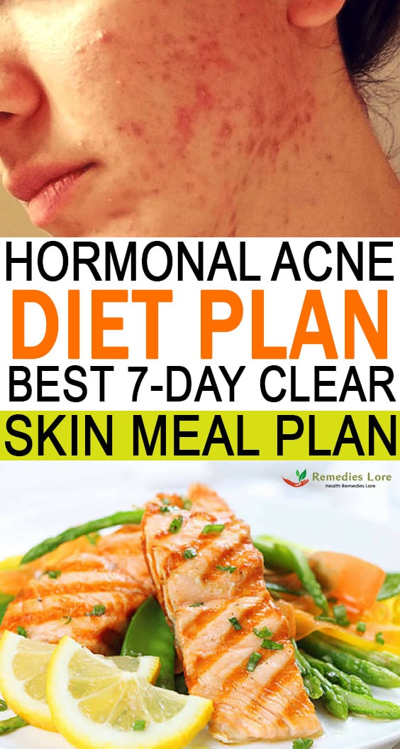 Hormonal Acne Diet Plan Best 7 Days Clear Skin Meal Plan Remedies Lore